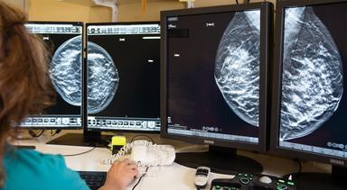 Tumore al seno, con diagnosi precoce la sopravvivenza a 10 anni supera il 90%