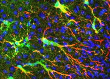 Il cervello può autoripararsi meglio di quanto si pensasse