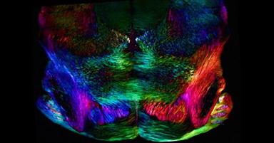 Lo stress vissuto nell'infanzia lascia cicatrici nel cervello