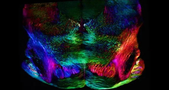 Lo stress vissuto nell'infanzia lascia cicatrici nel cervello