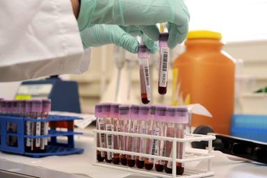 Donna morì per sangue infetto, Ministero Salute condannato 48 anni dopo