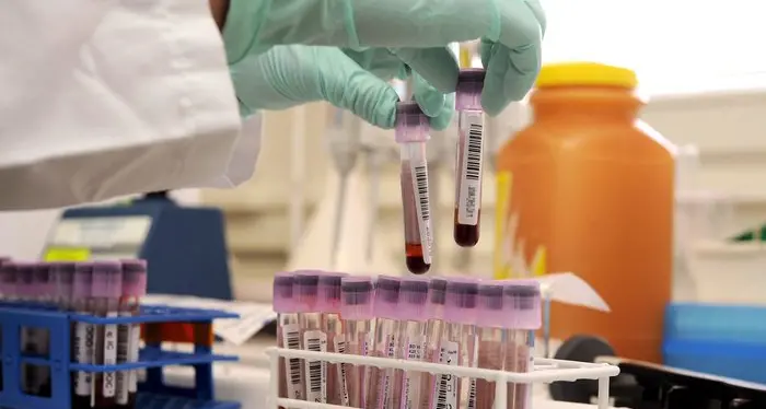 Donna morì per sangue infetto, Ministero Salute condannato 48 anni dopo