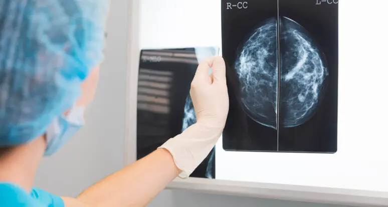 Mammografia: in Alto Adige una donna su dieci la fa in una struttura privata