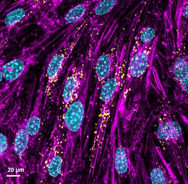 Verso virus ingegnerizzati per trasportare farmaci al cervello