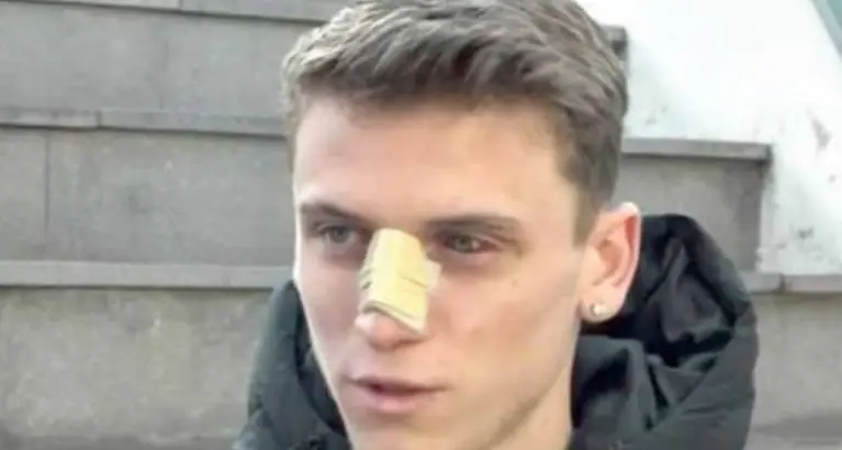 Il ragazzo pestato a Bressanone: «Avevo paura di morire»