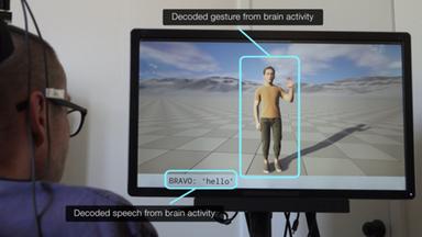 Un impianto cerebrale traduce gesti e parole in persone paralizzate