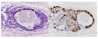 Riuscito in una scimmia il primo trapianto di ipofisi umana